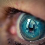 Aide au choix des lentilles de contact