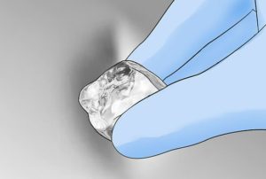 Alignement des bosses