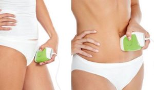 Procédure de photoépilation