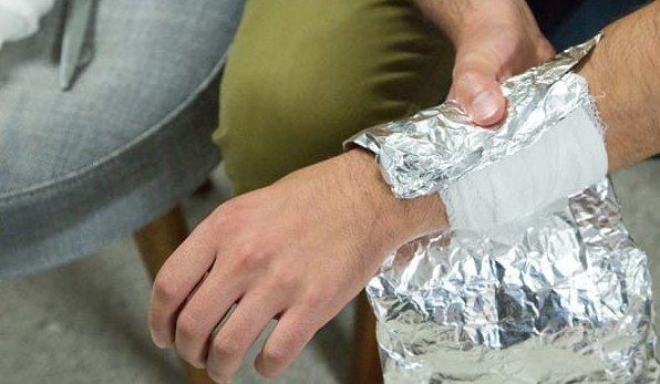 papier d'aluminium pour les brûlures