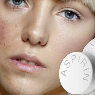 Utilisations inhabituelles de l'aspirine dans la vie quotidienne