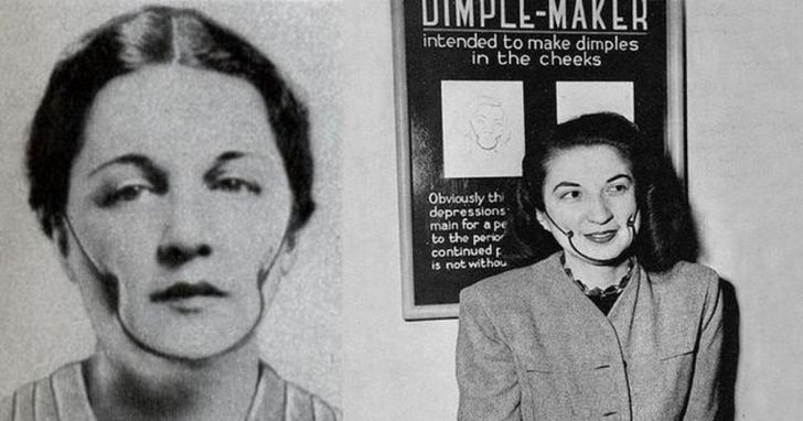 Appareil à fossettes